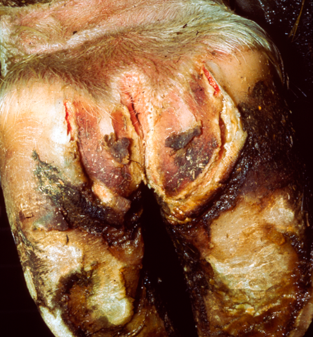 Interdigital Dermatitis Severity 1